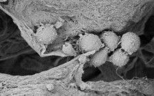 Cancer Stem Cells Embedded in Sanatela Matrix