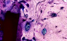 Histological evidence 31 months post implantation